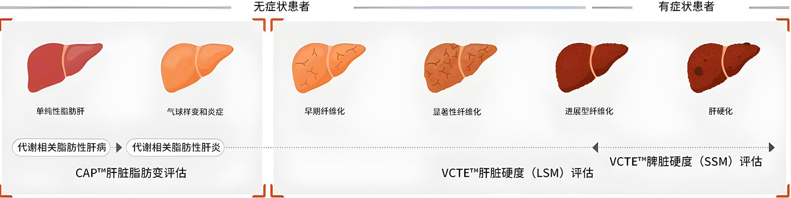 FibroScan?兩大核心技術